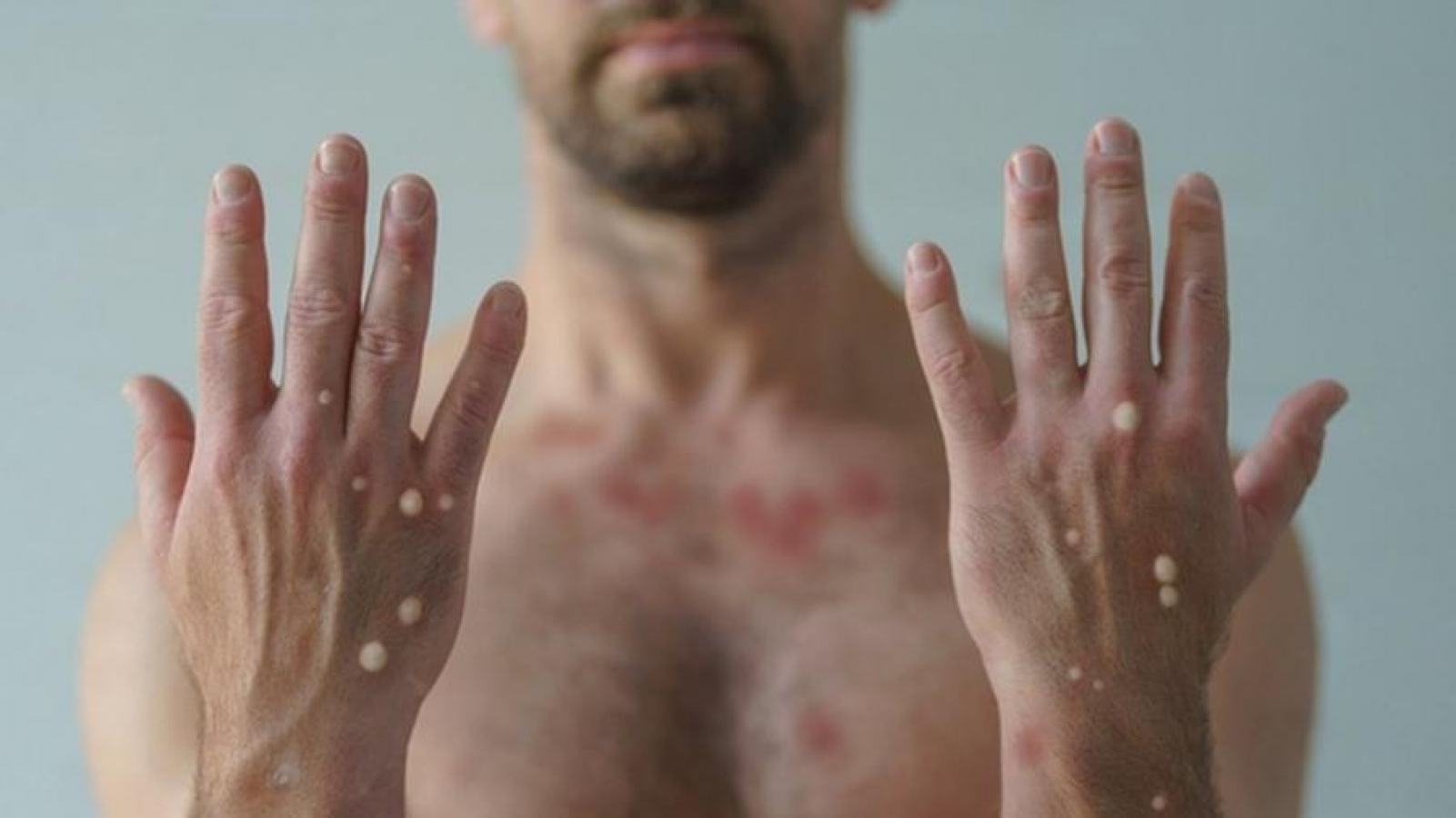 Foto: Getty Images